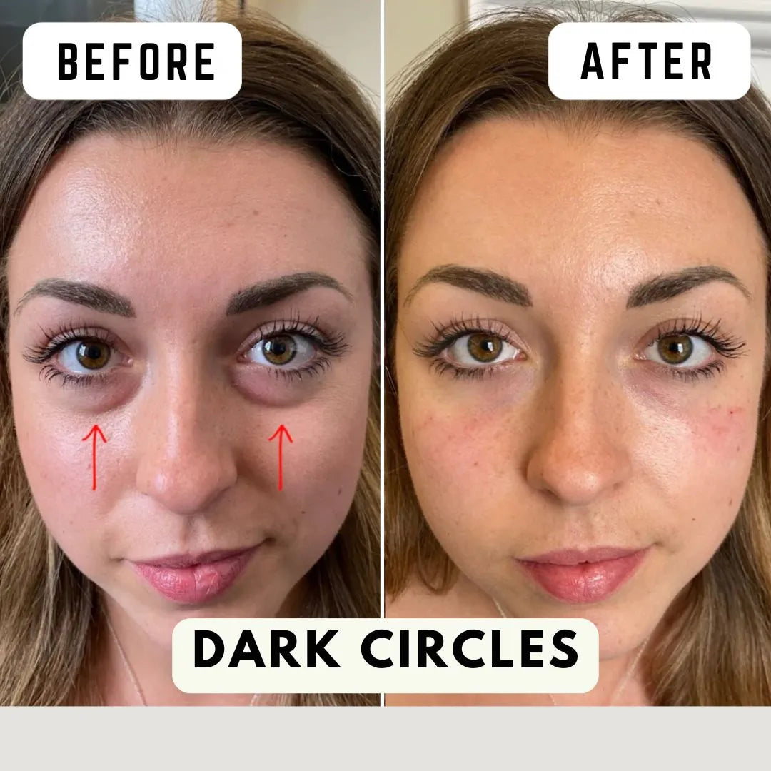 قناع العناية بالبشرة بالضوء | ضمان عام