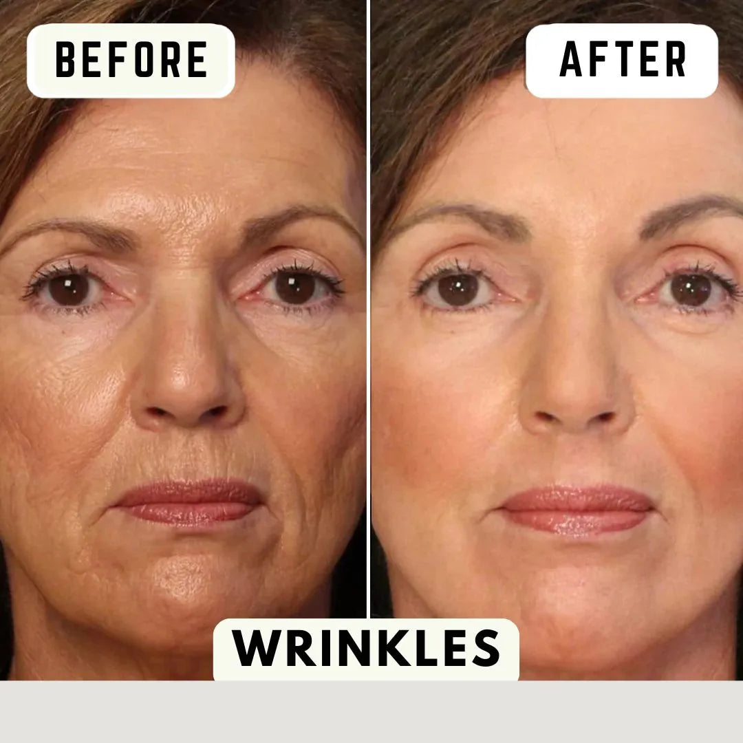 قناع العناية بالبشرة بالضوء | ضمان عام